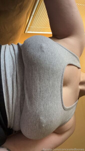 ConcealedBones