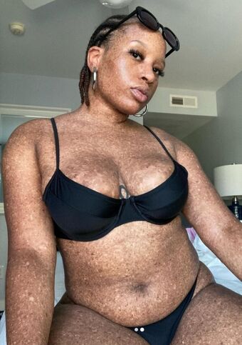 freckledn